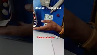 Widal test proceduretyphoid test Kaise kare mannual typhoid Slidefor dmlt student shortsvideo [upl. by Anirpas269]