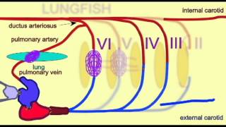 CVA3AORTIC ARCHESFROGavi [upl. by Tana755]