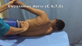 Clinical examination of the brachial plexus injury [upl. by Blodget]