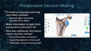 Exactech Launches Revision Systems for Hip Knee and Shoulder Surgery [upl. by Canute219]