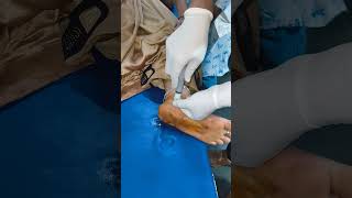 INTRAARTICULAR INJECTION FOR ANKLE PAIN [upl. by Leahcimnoj]