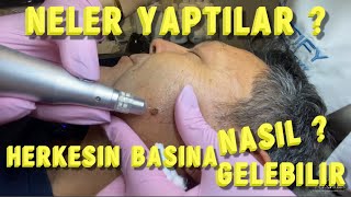 BENİM BAŞIMA GELEN SİZİN BAŞINIZA NASIL GELİR  GELİRSE NE YAPMANIZ GEREKİR PRETTİFY prettify [upl. by Marler]