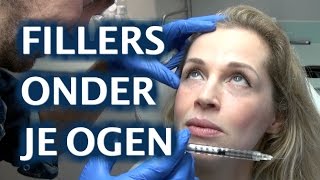 FILLERS onder je ogen  FURROWNL [upl. by Jehovah]