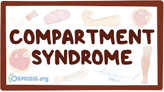 Compartment syndrome  an Osmosis Preview [upl. by Essy]