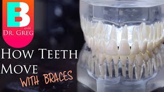 BRACES EXPLAINED How Teeth Move  Braces Work [upl. by Necila]