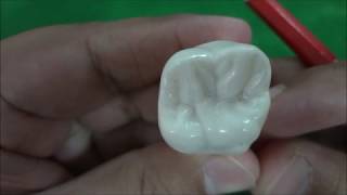 Maxillary Permanent First Molar Morphology [upl. by Foah]