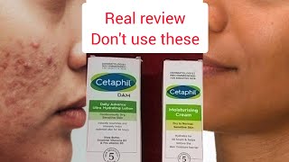 Cetaphil DAM ultra hydrating lotion Vs Cetaphil Moisturising Cream reviewhow to use cetaphil [upl. by Aenneea]