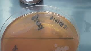 Serratia mercescens growth on broth  Bactec vial and MacConkey agar  Neonatal sepsis [upl. by Yesdnil732]