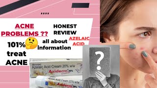 Aziderm CreamAziderm Cream Review  Azelaic acidMelasma amp Acneacne spot HyperpigmentionRosacea [upl. by Amat]