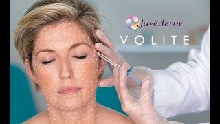 How to hydrate your skin from the inside out with Juvederm Volite at BC laser [upl. by Henrieta]