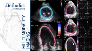 Echo Assessment of Chamber Morphology and LV Function Miguel A Quiñones MD October 13 2020 [upl. by Toile124]