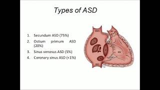 Sinus Venosus Atrial Septal Defect [upl. by Apilef]