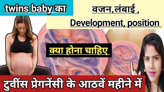 twins pregnancy ke 8 month me twins baby kaise hote h twins baby develop 8 month of twins pregnancy [upl. by Yrovi]