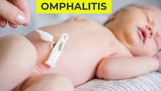 Omphalitis in Hindi  Neonatal Omphalitis  Nursinginnovationhindi [upl. by Misti324]