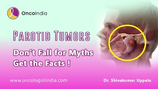 Parotid Tumors Don’t Fall for Myths – Get the Facts  Dr Shiva Kumar Uppala [upl. by Eimile]