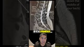 🧠 Entendendo a Ressonância Magnética Anatomia e Patologias 🧠 [upl. by Zacharias]