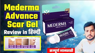 Mederma cream  mederma for acne scars  mederma advanced scar gel review Usesside effects [upl. by Boff]