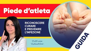 Piede d’atleta come riconoscere curare e prevenire l’infezione [upl. by Armyn]