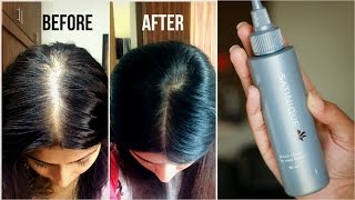 How to increase volume amp density of hair  Amways Satnique Scalp Tonic Review  Kavya K [upl. by Flori296]