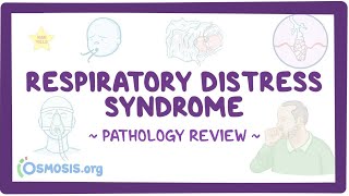 Respiratory distress syndrome Pathology Review [upl. by Annaeg]