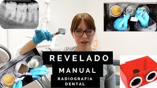 Revelado manual de radiografías dentales [upl. by Mccall361]