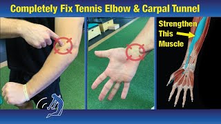 Fix Tennis Elbow in One Week  Exercises that Actually Work [upl. by Gilliam]