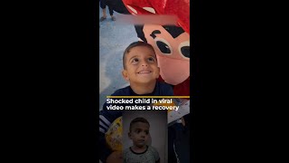 Shocked child in viral video from Gaza makes a recovery  AJ shorts [upl. by Banyaz875]