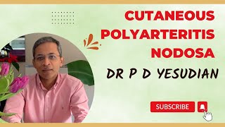 Cutaneous polyarteritis nodosa  a comprehensive review Dermatologist explains [upl. by Maribel3]