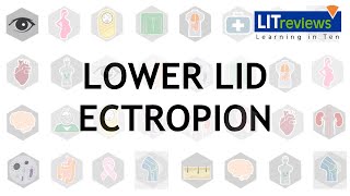 Lower Lid Ectropion [upl. by Mil296]