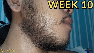 FILIPINO BEARD GROWTH USING MINOXIDIL WEEK 10 RESULTS [upl. by Aenet]