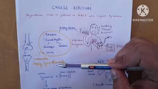 Cheese Reaction Unveiled Tyramine and MAO Inhibitors Explained [upl. by Akemit]