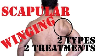 Scapular Winging Fix  Treat Medial And Lateral Winging [upl. by Yebloc704]