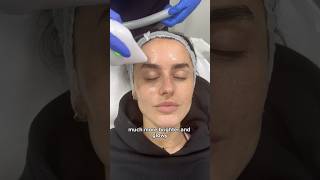 Amber Davies Skin Tightening amp Rejuvenation Journey at Dr MediSpa [upl. by Oicam109]