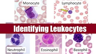 Identifying Leukocytes [upl. by Hollie]