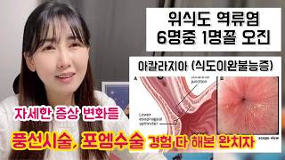 역류성식도염 오진 결국 아칼라지아 식도이완불능증 아주대 풍선시술 차병원 포엠수술 다해본 완치자 자세한 증상부터 입원 퇴원까지 [upl. by Agarhs]