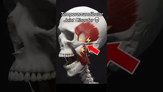 Temporomandibular Joint Dysfunction TMJ  TMD [upl. by Korb]