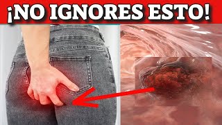 ¡CÁNCER de COLON SÍGNOS y SÍNTOMAS de ALERTA que NUNCA DEBES IGNORAR [upl. by Mabel]