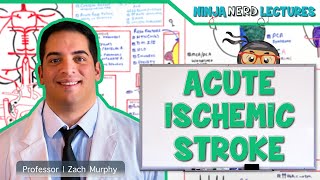 Acute Ischemic Stroke Etiology Pathophysiology Clinical Features Diagnostics Treatment [upl. by Assetniuq]