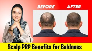 Hair Baldness Treatment  How to make hair grow faster thicker and stronger  prp for hair benefits [upl. by Seyler972]