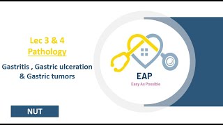 Lec 3 amp 4  Pathology  Gastritis  Gastric ulceration amp Gastric tumors  NUT [upl. by Naillil]