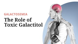 Galactosemia Pathogenesis The Role of Toxic Galactitol [upl. by Amalia]