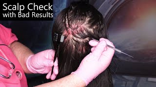 ASMR Scalp Check with Bad Results School Nurse Lice Check Scalp Massage Medical Roleplay [upl. by Imotih]