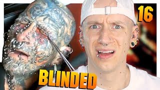 Reacting To Eyelid Piercing Fails  Piercings Gone Wrong 16  Roly Reacts [upl. by Dustan237]