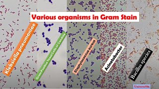 Various Bacteria Gram Stain MicroscopyGrampositive rodsGramNegative RodsGrampositive cocci [upl. by Arlana]