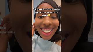 My Ortho Put A Belt Across My Teeth 😩 Orthodontist Reacts [upl. by Noyart296]