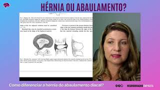 Hérnia discal ou abaulamento discal como identificar essa diferença [upl. by Ablasor]