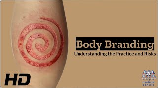 Body Branding Understanding the Practice and Risks [upl. by Ttcos]