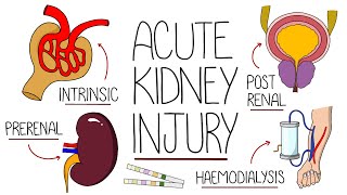 Understanding Acute Kidney Injury AKI Made Easy [upl. by Atwood]