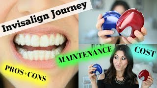 Invisalign Journey  Review On Cost Pros amp Cons Maintenance amp More [upl. by Aikyt229]