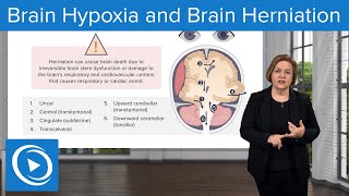 Brain Hypoxia and Brain Herniation – MedSurg Nursing  Lecturio [upl. by Arras]